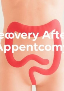 Recovery After Appendectomy: What to Expect and How to Heal Faster
