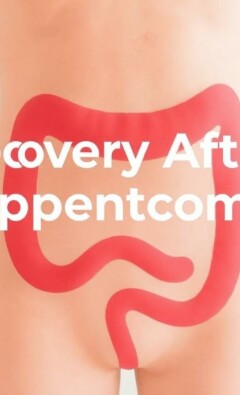 Recovery After Appendectomy: What to Expect and How to Heal Faster