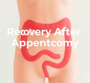 Recovery After Appendectomy: What to Expect and How to Heal Faster