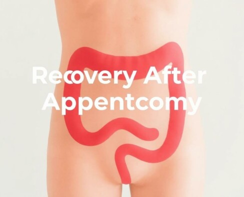 Recovery After Appendectomy: What to Expect and How to Heal Faster