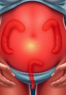 Appendicitis and Pregnancy: What Every Expectant Mother Needs to Know