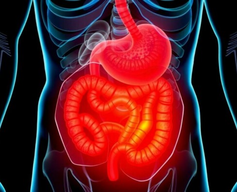 Alternativas naturales para «soñar» con la apendicitis: mitos, peligros y lo que realmente debes saber