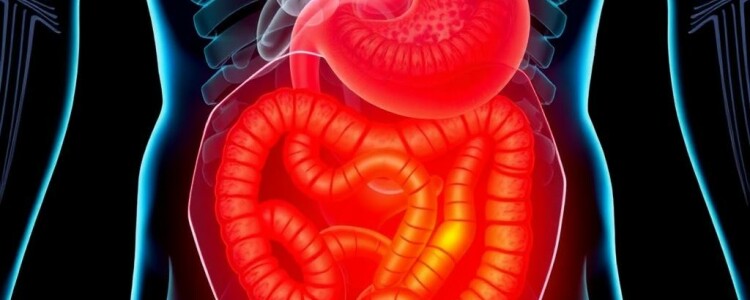 Alternativas naturales para «soñar» con la apendicitis: mitos, peligros y lo que realmente debes saber