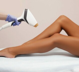 Главные плюсы лазерной эпиляции