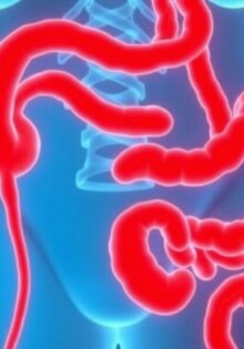 Apéndice y EII: desentrañando la sorprendente conexión entre la apendicitis y la enfermedad inflamatoria intestinal