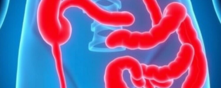 Apéndice y EII: desentrañando la sorprendente conexión entre la apendicitis y la enfermedad inflamatoria intestinal