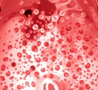 Leukozyten bei Blinddarmentzündung: Wichtiger Laborwert für Diagnose und Behandlung