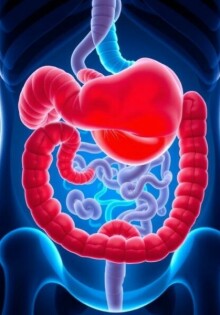 La péritonite généralisée : une urgence vitale — Entender, reconocer y actuar a tiempo