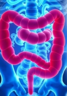Recurrent Appendicitis After Appendectomy: Understanding the Rare but Real Possibility