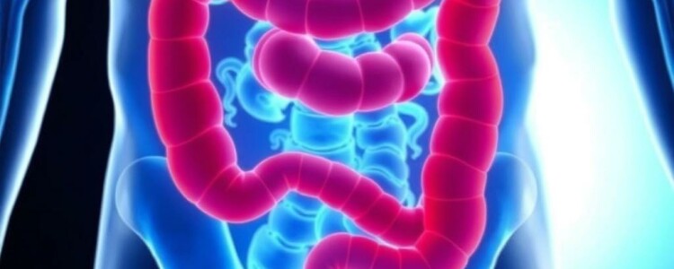 Recurrent Appendicitis After Appendectomy: Understanding the Rare but Real Possibility
