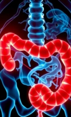 Rezidivierende Appendizitis: Kann sie wiederkommen?