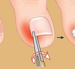 Крокодилы: Где обитают эти древние рептилии?