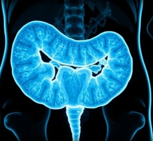 Karzinoid des Appendix: Eine seltene Tumorform im Fokus