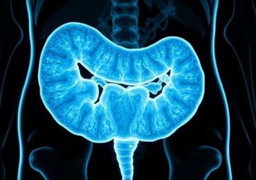 Karzinoid des Appendix: Eine seltene Tumorform im Fokus