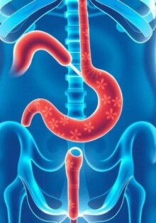 Appendizitis und Durchfall: Zusammenhang und Bedeutung verstehen