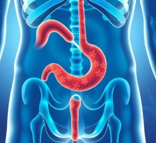 Appendizitis und Durchfall: Zusammenhang und Bedeutung verstehen