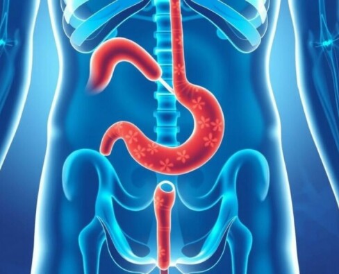 Appendizitis und Durchfall: Zusammenhang und Bedeutung verstehen