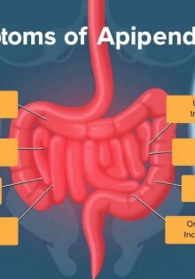Understanding the Symptoms of Appendicitis: What You Need to Know