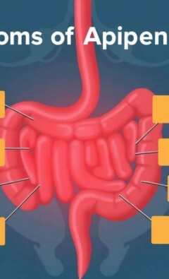 Understanding the Symptoms of Appendicitis: What You Need to Know