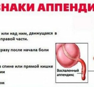 Холестаз печени: что это такое и как его распознать