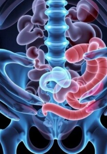 Treatment Options for Appendicitis: Understanding Your Choices