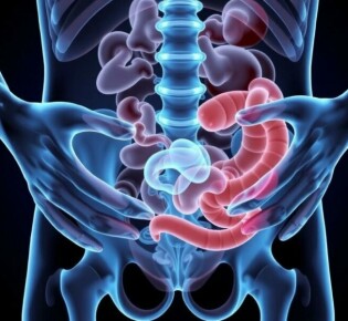 Treatment Options for Appendicitis: Understanding Your Choices