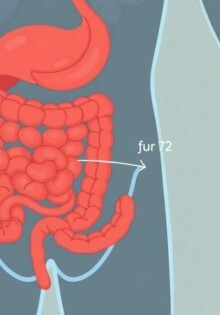 Understanding Loss of Appetite in Appendicitis: What Your Body is Telling You