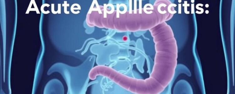 Appendicite Aiguë : Causes et Facteurs de Risque