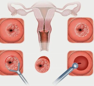 Соболь: Удивительный Мир Этих Элегантных Хищников