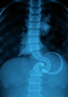 Les limites de la radiographie standard de l’abdomen: por qué ya no siempre basta y cuándo aún tiene sentido usarla