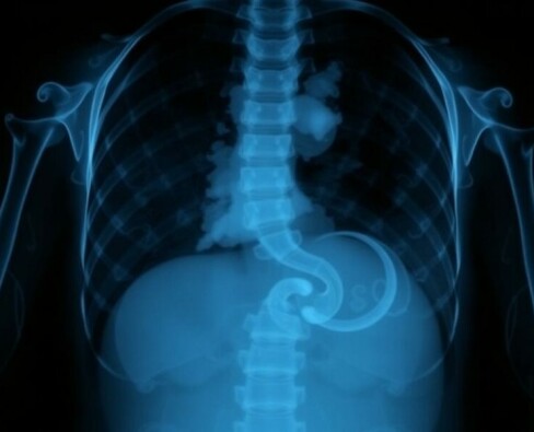 Les limites de la radiographie standard de l’abdomen: por qué ya no siempre basta y cuándo aún tiene sentido usarla