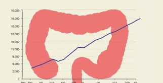 Understanding Appendicitis Mortality Rates: What You Need to Know