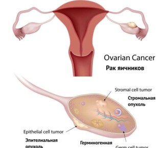 Хронический холецистопанкреатит: что это такое и как с ним бороться