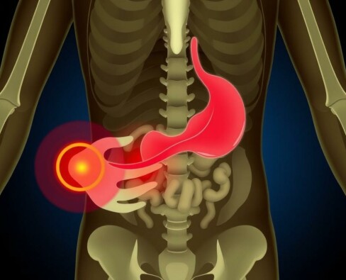 La phase d’obstruction et de distension (douleur colique): Entender la tormenta dentro del abdomen