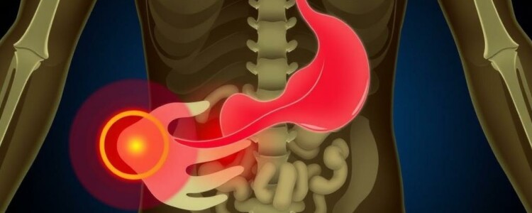 La phase d’obstruction et de distension (douleur colique): Entender la tormenta dentro del abdomen