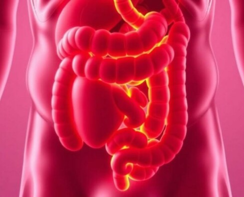 Peritonitis: Cuando la apendicitis se convierte en una emergencia que puede costar la vida