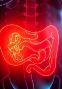 Psoas-Zeichen: Was bedeutet dieses Appendizitis-Symptom?