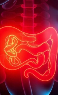 Psoas-Zeichen: Was bedeutet dieses Appendizitis-Symptom?