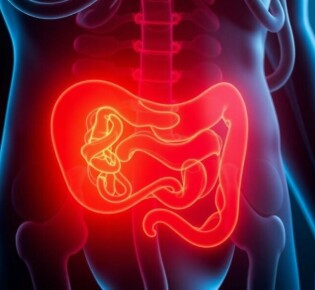 Psoas-Zeichen: Was bedeutet dieses Appendizitis-Symptom?