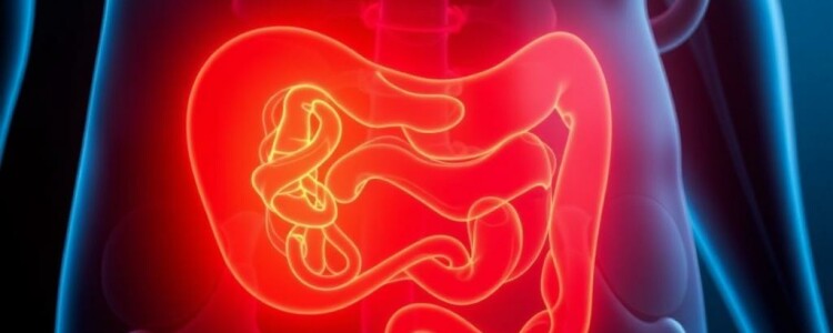 Psoas-Zeichen: Was bedeutet dieses Appendizitis-Symptom?