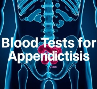 Blood Tests for Appendicitis: What You Need to Know