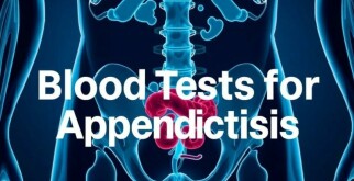 Blood Tests for Appendicitis: What You Need to Know