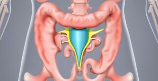 La válvula ileocecal: el pequeño guardián entre intestino delgado y grueso