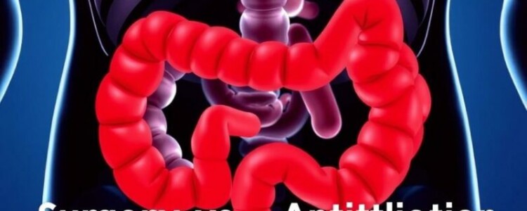 Comparando resultados: cirugía vs. antibióticos para la apendicitis