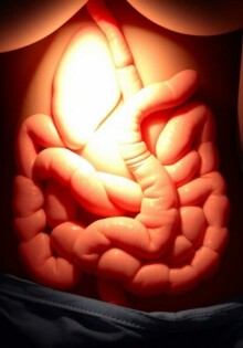 L’occlusion intestinale postopératoire: cuando el intestino guarda silencio después de la cirugía