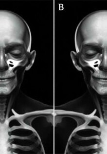 L’examen physique: la manoeuvre de McBurney y sus variantes — una guía práctica y conversacional para entender, aplicar y valorar un clásico de la exploración abdominal