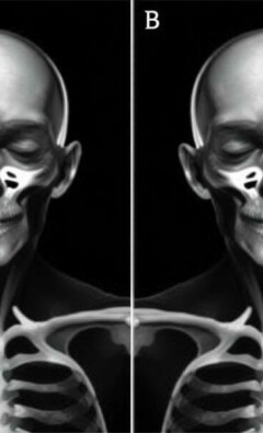 L’examen physique: la manoeuvre de McBurney y sus variantes — una guía práctica y conversacional para entender, aplicar y valorar un clásico de la exploración abdominal