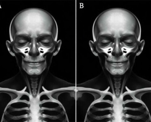 L’examen physique: la manoeuvre de McBurney y sus variantes — una guía práctica y conversacional para entender, aplicar y valorar un clásico de la exploración abdominal