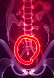 ¿Puede la apendicitis ser asintomática? Descubriendo el «silencio» del apéndice