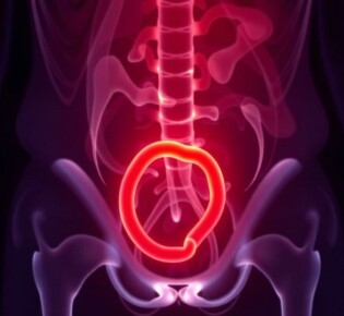 ¿Puede la apendicitis ser asintomática? Descubriendo el «silencio» del apéndice